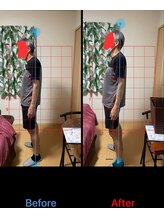 フラット(FLAT)/Before After