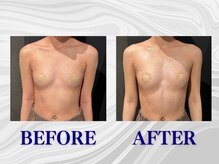 ザモア 福岡天神(THE MORE)/【症例 Before After】