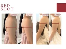 シャンディール(shandeel)/レッドショット