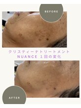 メゾン カルム 天文館店(MAISON CALME)/肌質改善