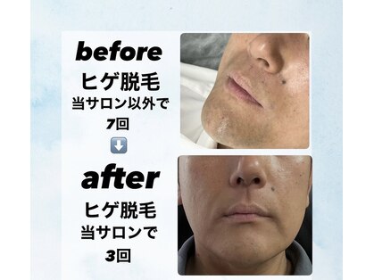 ノーブル(NOBLE)の写真