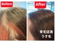 かこ鍼灸院の写真/もう周りの目をきにしなくていい！自分の力で自然と髪の毛が生えるように！広島/育毛促進/鍼灸/中区/肩こり