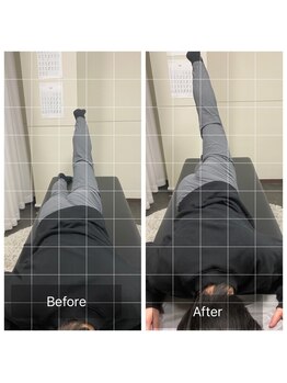 ナオル整体 浅草院(NAORU整体)/20代女性腰痛【股関節の可動域】