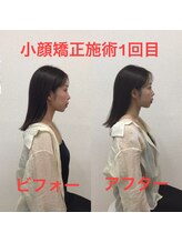 オズ六本木/六本木小顔矯正（造顔）姿勢整う