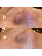 アース コアフュールボーテ 新潟紫竹山店(EARTH coiffure beaute)/毛穴洗浄