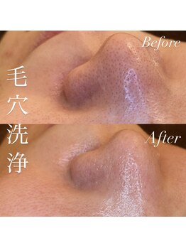 アース コアフュールボーテ 新潟紫竹山店(EARTH coiffure beaute)/毛穴洗浄