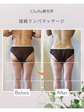 チュラ鍼灸院 西宮北口(ChuRa鍼灸院)/小尻・美尻・下半身太り解消