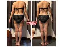 エステティックサロン リアン(Lien)/上半身痩せのお客様