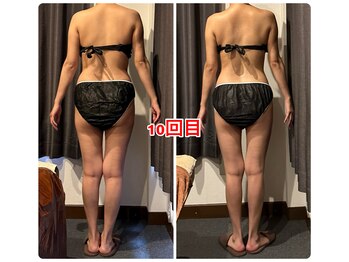 エステティックサロン リアン(Lien)/上半身痩せのお客様