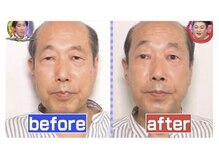 アジーク 町田店(AGEQUE)/TV出演の本格たるみ改善サロン