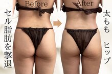 タノソイネ(tanosoine)