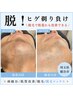 《★メンズ脱毛No.1》毎日の髭剃りから卒業！美肌パックヘッドマッサージ付き