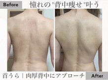 【よもぎ蒸し温活痩身×水素吸入】YOSAPARK ALUA FEM/気がついたら、背面美人も叶う