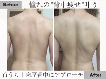 【よもぎ蒸し温活痩身×水素吸入】YOSAPARK ALUA FEM/気がついたら、背面美人も叶う