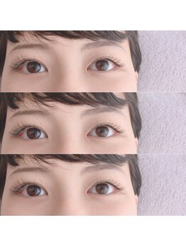 エマ 長岡天神(emma)/シルクプロテインラッシュ150本