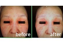 ファイブエレガンテ(5Elegante)/