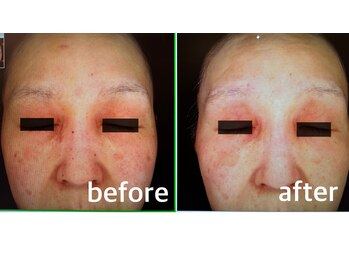 ファイブエレガンテ(5Elegante)/