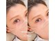 アリルアイラッシュ(ALiLu Eye Lash)の写真