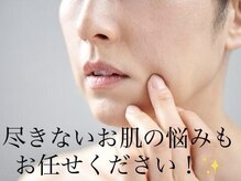 ヨサパーク リノ(YOSA PARK Lino)
