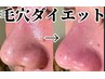 【毛穴の黒ずみが1発で消える】毛穴侍＆松ヤニパック