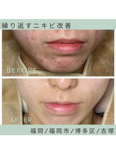 ソワ 吉塚店(soi)/ずっと繰り返していた。