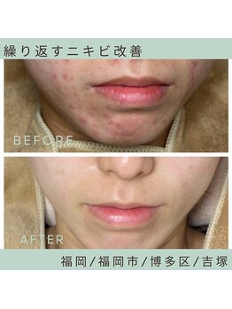 ソワ 吉塚店(soi)/ずっと繰り返していた。