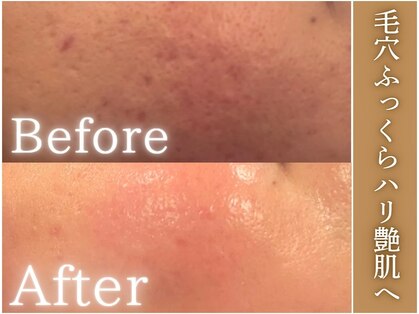 サロンドエステ ルヴニール(salon de esthe revenir)の写真