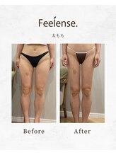フィーレンス(Feelense.)/太もも、痩身、短期痩せ、減量