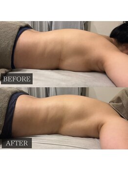 ツカ(TSUKA)/背中の丸みが気になる方に！