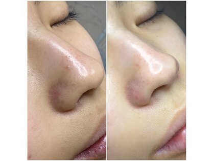 プルティティア 池下 今池 覚王山(Pultitia)の写真