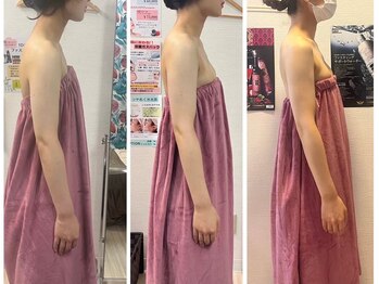 ロココ 錦糸町店(Rococo)/比較写真