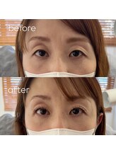 メロー(MELLOW)/まつ毛