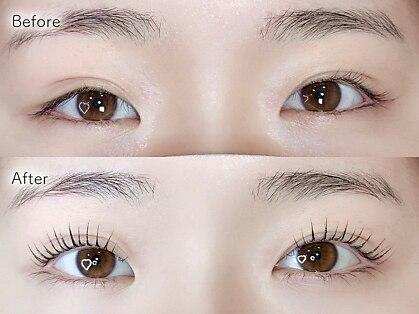 アイビー 岡山南区(eyebee)の写真