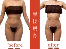 ウィズルーチェ 神栖店(with luce)/産後痩身効果★痩せない身体に