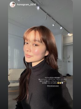 ニュート 表参道 外苑前(NUUT)/NUUT/ニュート/美容鍼/鍼灸/小顔