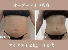 クリアー(clear)の雰囲気（着たい服を楽しめる自分へ。何したの？って聞かれるレベルの変化）