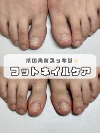 サンダル準備！フットネイルケア