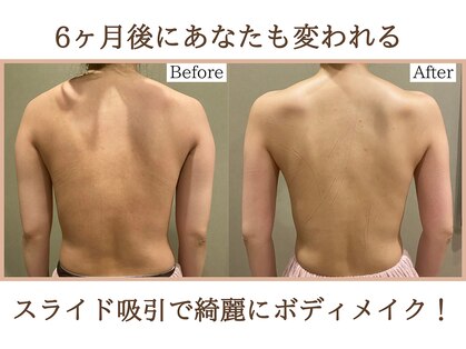 エス シークレット 金町店(S secret)の写真