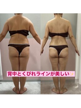 メンサス 湘南藤沢店(mensus)/3か月ダイエット