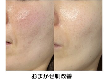 ボンズ(bonds.)/お任せ肌管理