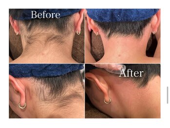 ジョエルワックス 沖縄那覇店(JOELLE WAX)/うなじダブル脱毛★