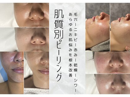 レアリゼ(Realiser)の写真