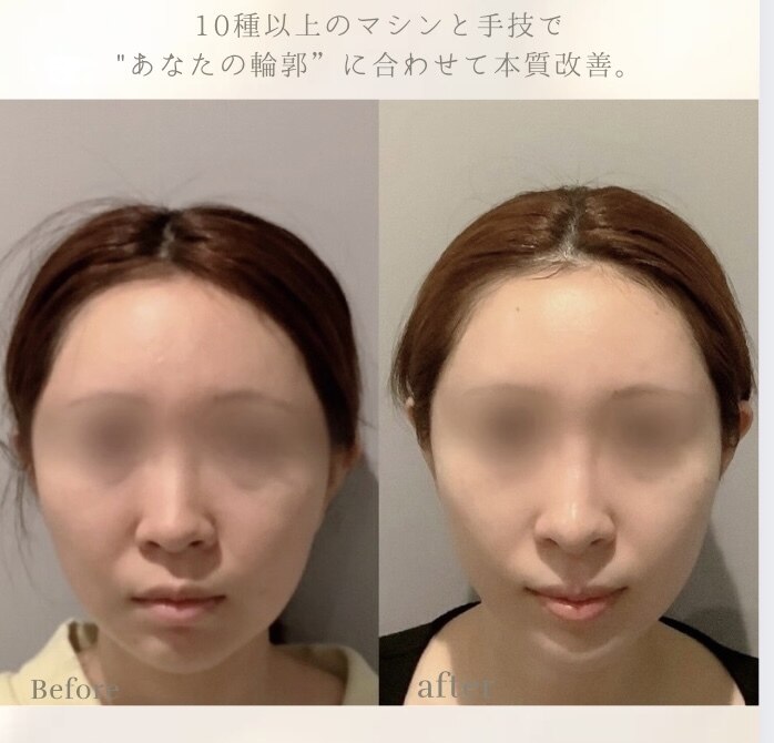 美容整骨小顔ラボ｜ホットペッパービューティー