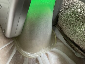 ビバク 吉祥寺駅前店(BIBAKU)の写真/「脂肪冷却痩身」専門店★圧倒的美BODYを短期間で目指せる！メンズのお客様も大歓迎！