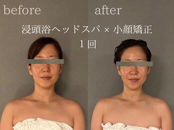 モンデュ(MonDue)/浸頭浴ヘッドスパ×小顔矯正