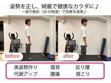 中京こじま整骨院/姿勢矯正