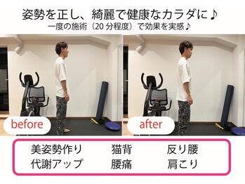 中京こじま整骨院/姿勢矯正