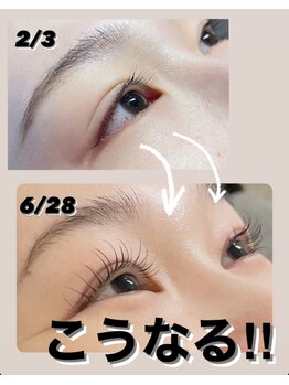 バンビちゃんのお目目 熊本店/たった数ヶ月でこんなに変わる！