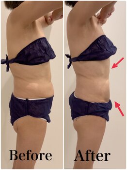 スペチアーレ 夙川/柔らかい脂肪にオススメ