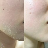 ルアナ ワックス サロン(LUANA Waxing Salon)